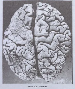 Предполагаемая фотография мозга Ленина